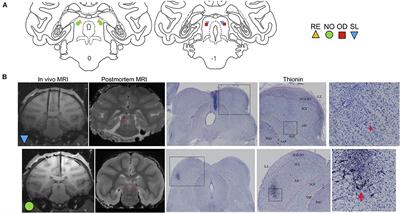 Inhibition of the Deep and Intermediate Layers of the Superior Colliculus Disrupts Sensorimotor Gating in Monkeys